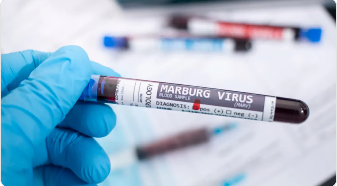 Rwanda records 6 deaths from Marburg virus